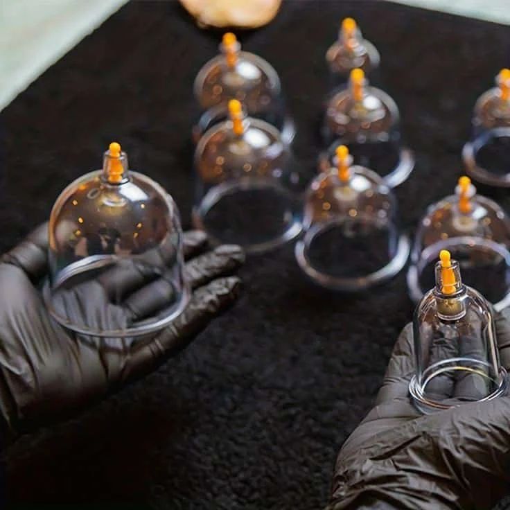 The Best Cupping Therapy Services in Nairobi - Mostfit Physiotherapy Center