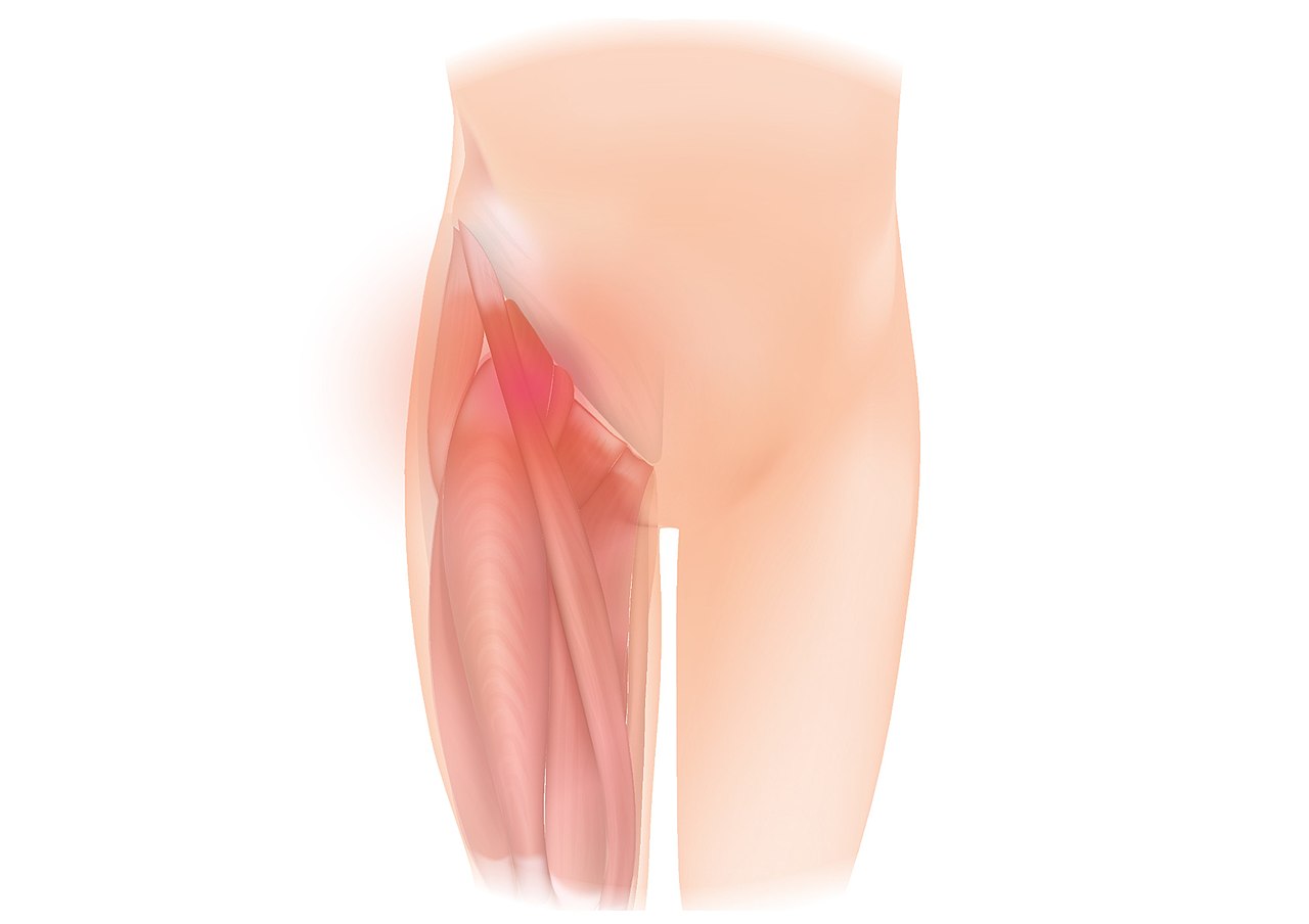 The Best Hip Pain Physiotherapy Services in Nairobi - Mostfit Physiotherapy Center